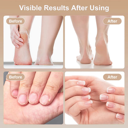 Professional Pedicure Tool